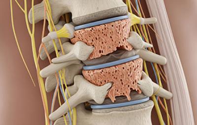 Degenerative Disc Disease Schedule An Appointment
